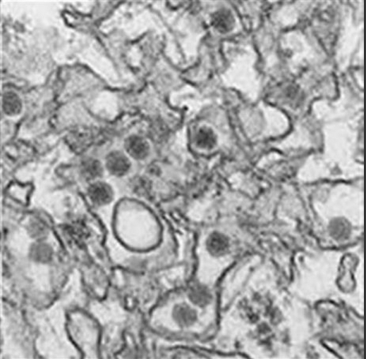 FILE - This January 2016 microscope image provided by the Centers for Disease Control and Prevention shows the Zika virus. On Friday, the CDC said a New York City woman infected her male partner with Zika virus through sex, the first time female-to-male transmission of the germ has been documented. Cynthia Goldsmith/CDC via AP