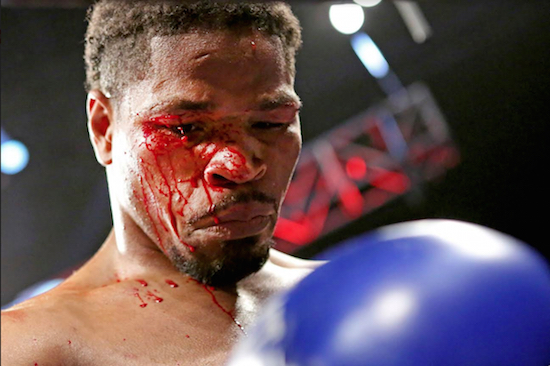 Shawn Porter emerged bloodied but unbowed following his ninth-round TKO victory over Andre Berto Saturday night at Downtown’s Barclays Center. AP photo
