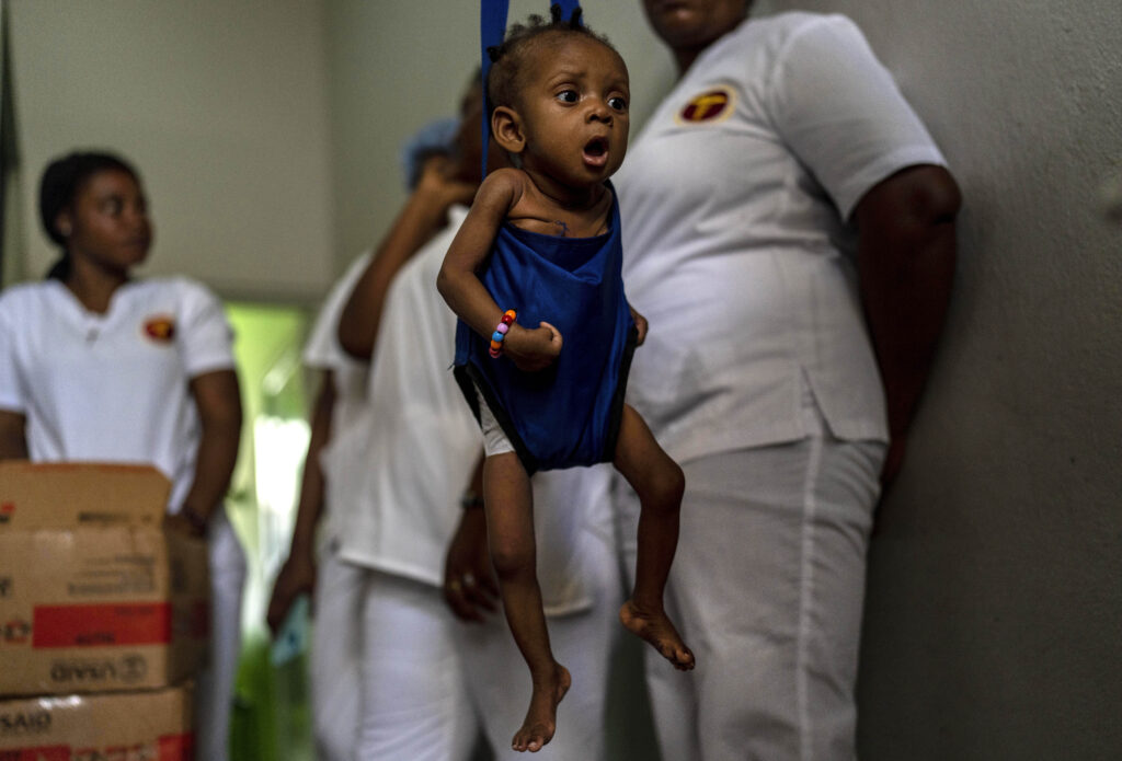 A child suffering from malnutrition is weighed by health workers at La Paix University Hospital, in Port-au-Prince, Haiti, Wednesday, May 8, 2024. (AP Photo/Ramon Espinosa)