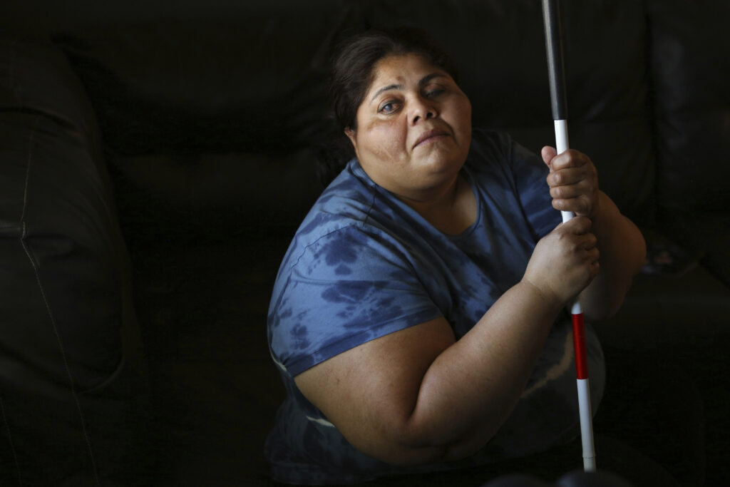 Marvin Estela Pineda, originally from El Salvador and who is blind from glaucoma, poses for a photo at her home in Madera, Calif., Thursday, May 30, 2024. California Gov. Gavin Newsom is facing criticism for his proposal to eliminate an optional Medicaid benefit for some disabled immigrants. (AP Photo/Gary Kazanjian)