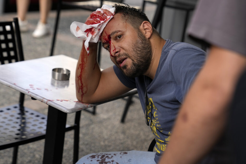 A protester bleeds after clashes with police outside a court house in Kalamata, southwestern Greece, on Tuesday, May 21, 2024. Nine Egyptian men go on trial in southern Greece on Tuesday, accused of causing a shipwreck that killed hundreds of migrants and sent shockwaves through the European Union’s border protection and asylum operations. (AP Photo/Thanassis Stavrakis)