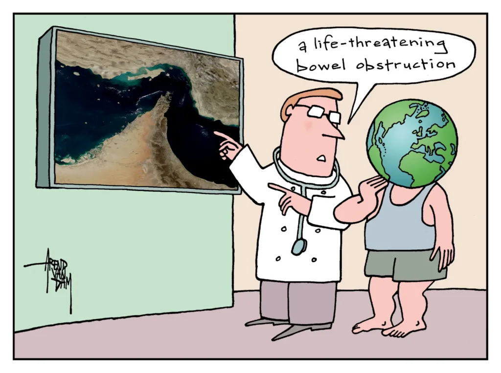 Bowel Obstruction by Arend van Dam