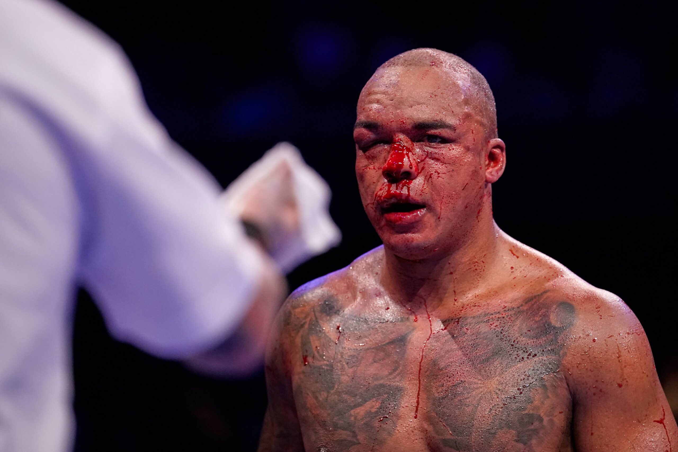 Britain's Fabio Wardley walks back to his corner bloodied by Britain's Daniel Dubois during their WBO World Heavyweight boxing title bout in Manchester, Saturday, May 9, 2026. Photo: Dave Thompson/AP